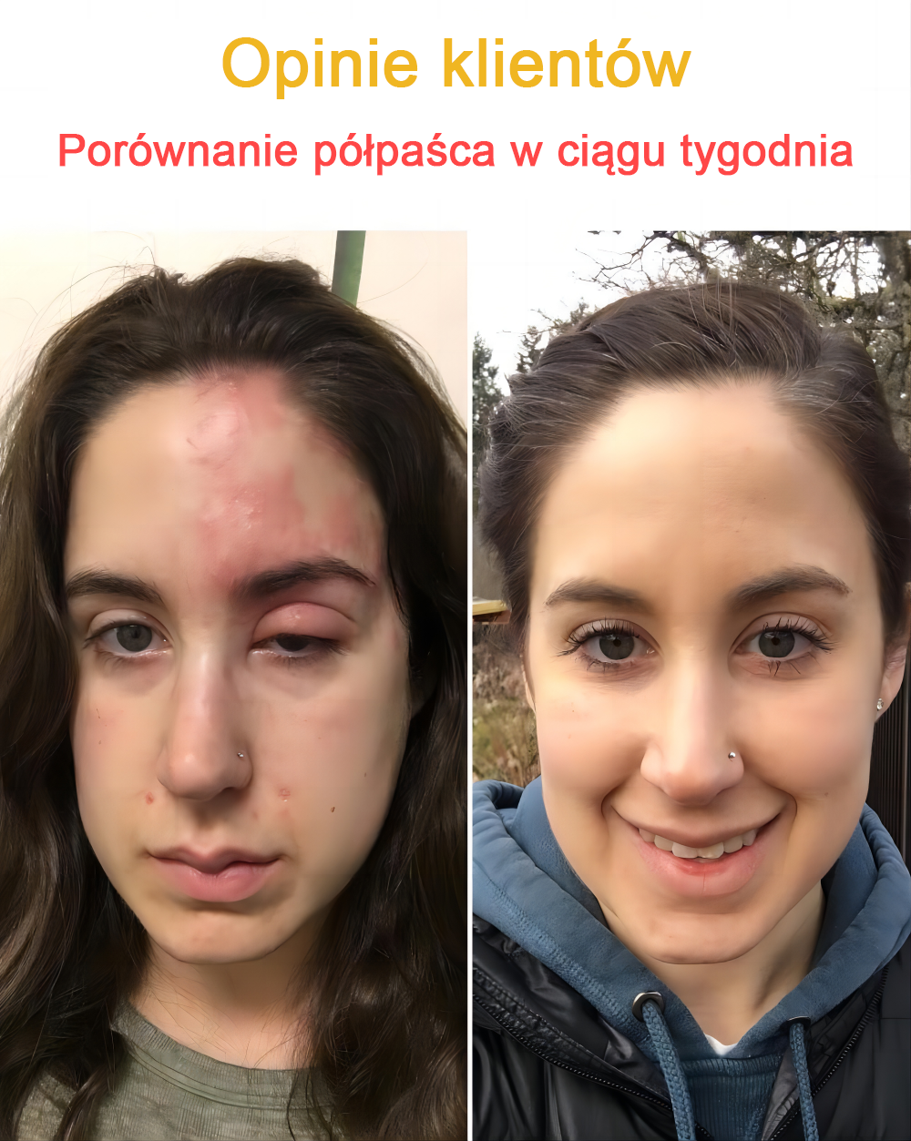 🐝✨𝑩𝑺𝑾𝑬𝑳𝑳® Krem z jadami pszczół 👨‍⚕️ (Rekomendacja dermatologów) (🔥Ostatni dzień promocji, 80% zniżki)