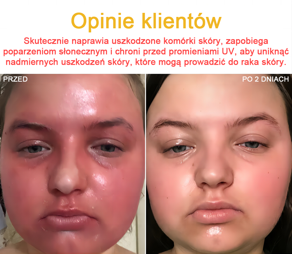 🐝✨𝑩𝑺𝑾𝑬𝑳𝑳® Krem z jadami pszczół 👨‍⚕️ (Rekomendacja dermatologów) (🔥Ostatni dzień promocji, 80% zniżki)