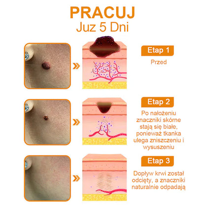 【🌊 Za pobraniem🌊 】 Vsoxa™ Krem do usuwania brodawek i pieprzyków z jadem pszczelim (👨‍⚕Zalecenia AAD) 🐝🐝 (🔥Ostatni dzień wyprzedaży 70% taniej)