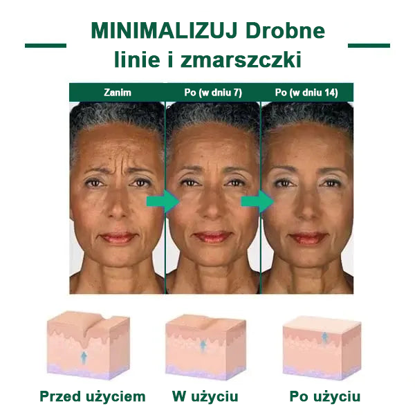 【✨Za pobraniem✨】Wyprzedaż ostatniego dnia 80% taniej - Ujędrniające serum regenerujące Fubsta™