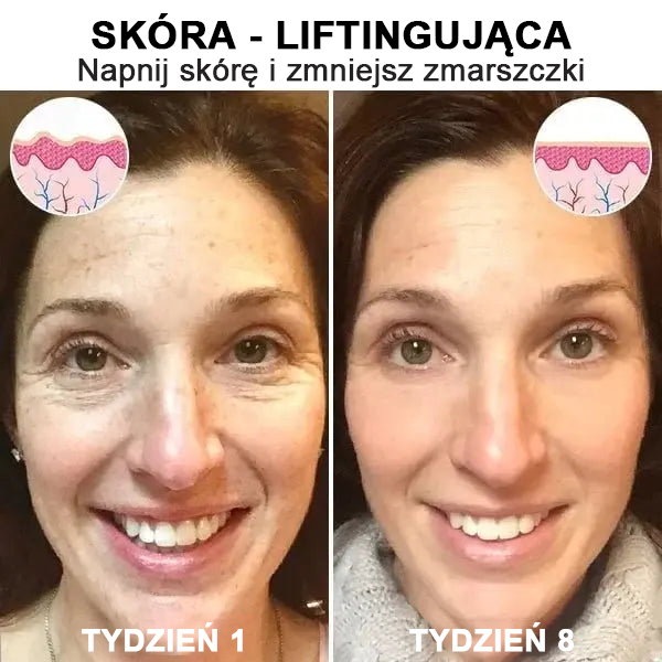 【✨Za pobraniem✨】Wyprzedaż ostatniego dnia 80% taniej - Ujędrniające serum regenerujące Fubsta™