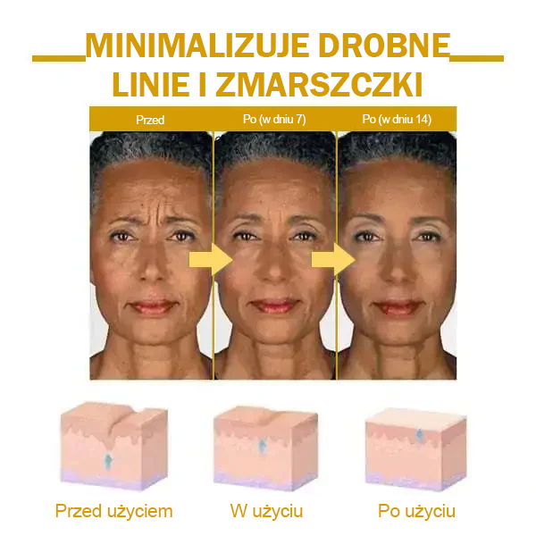 🌟🌟Zniżka ostatniego dnia: 70% ZNIŻKI LEFUN® Ujędrniający olejek odmładzający skórę