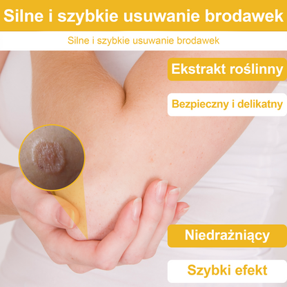 ✨🎁Krem FROPUN do usuwania pieprzyków i znamion (ostatni dzień promocji 85% taniej)