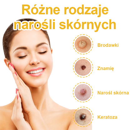 ✨🎁Krem FROPUN do usuwania pieprzyków i znamion (ostatni dzień promocji 85% taniej)