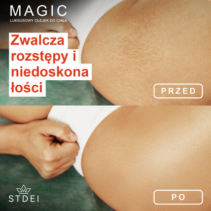 STDIE™ Magiczny luksusowy olejek do ciała ( Ograniczona oferta czasowa – 80% zniżki – ostatnie 30 minut)🌹🔥