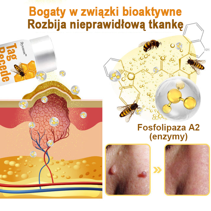 flysmus™ Sprej z jadem pszczelim do usuwania brodawek i znamion skórnych 🐝