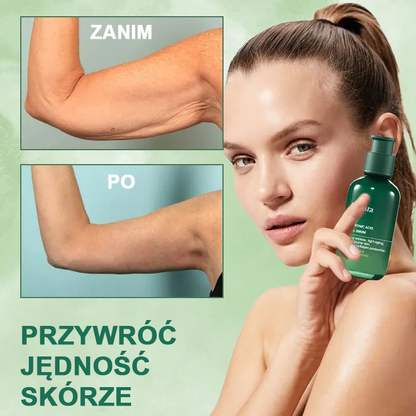 【✨Za pobraniem✨】Wyprzedaż ostatniego dnia 80% taniej - Ujędrniające serum regenerujące Fubsta™