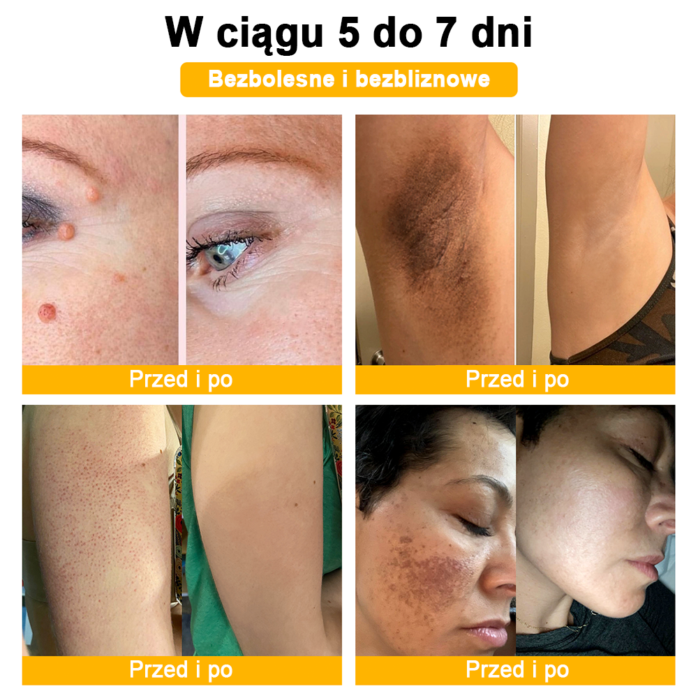 🐝✨𝑩𝑺𝑾𝑬𝑳𝑳® Krem z jadami pszczół 👨‍⚕️ (Rekomendacja dermatologów) (🔥Ostatni dzień promocji, 80% zniżki)