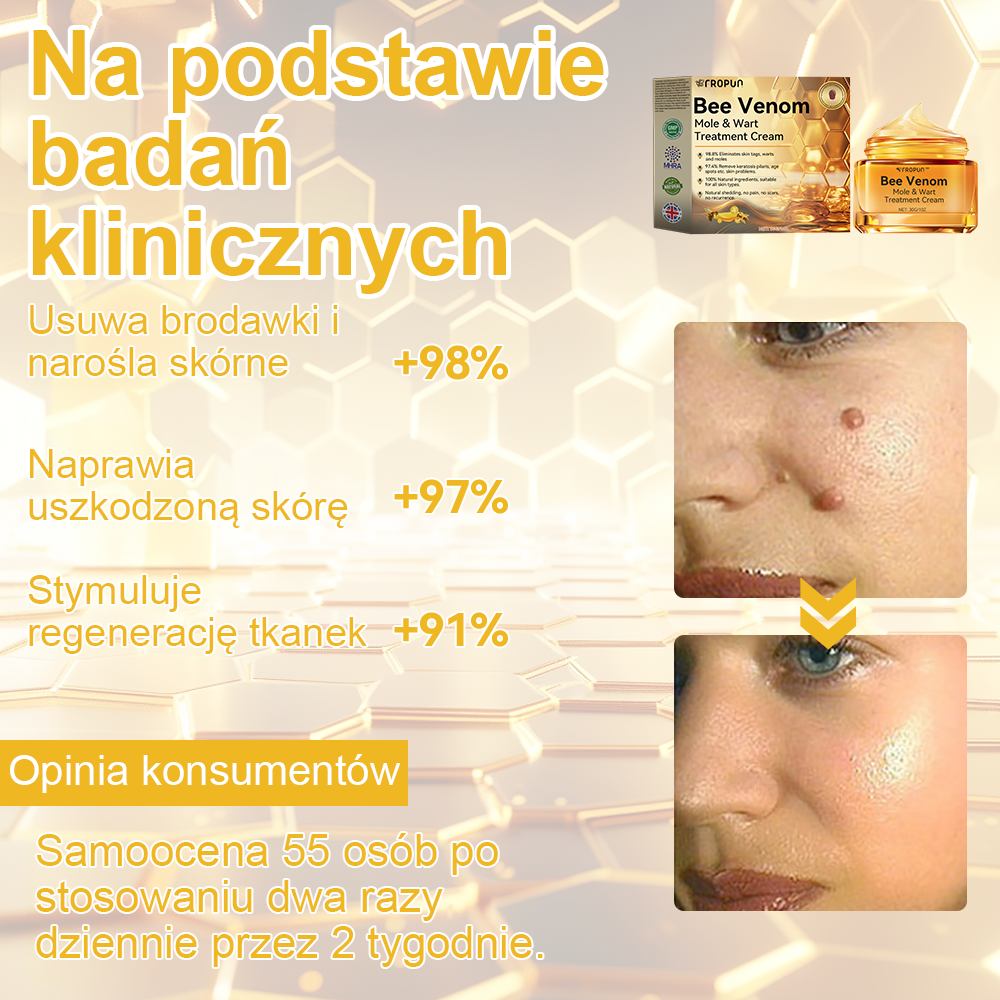 ✨🎁Krem FROPUN do usuwania pieprzyków i znamion (ostatni dzień promocji 85% taniej)