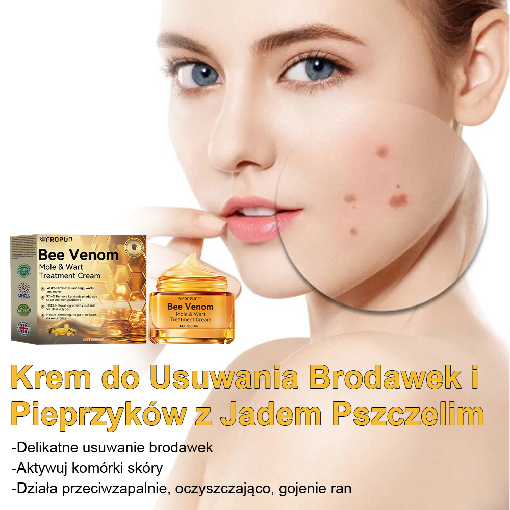 ✨🎁Krem FROPUN do usuwania pieprzyków i znamion (ostatni dzień promocji 85% taniej)