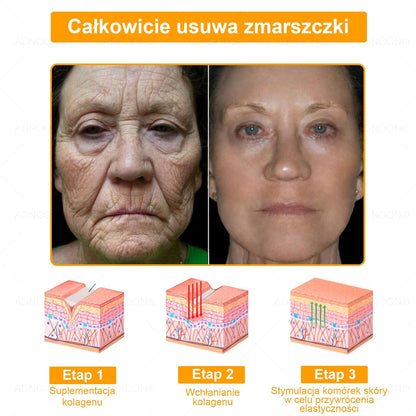 ADNOON® 🌼-Dzienna Szybka Krem Naprawczy Skórę - Polecany przez Dr. Irenę Eris 👨‍⚕️