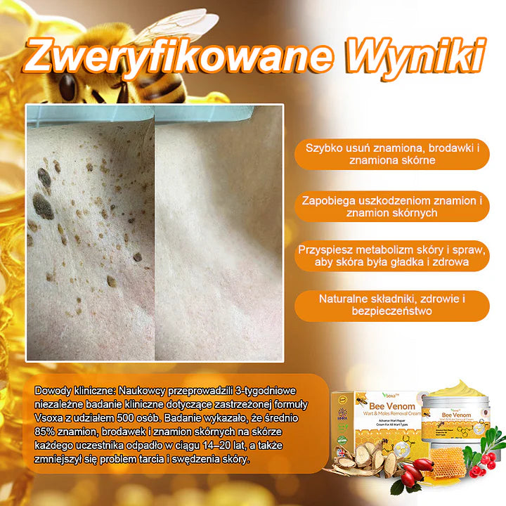 【🌊 Za pobraniem🌊 】 Vsoxa™ Krem do usuwania brodawek i pieprzyków z jadem pszczelim (👨‍⚕Zalecenia AAD) 🐝🐝 (🔥Ostatni dzień wyprzedaży 70% taniej)