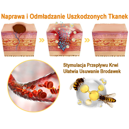 flysmus™ Sprej z jadem pszczelim do usuwania brodawek i znamion skórnych 🐝