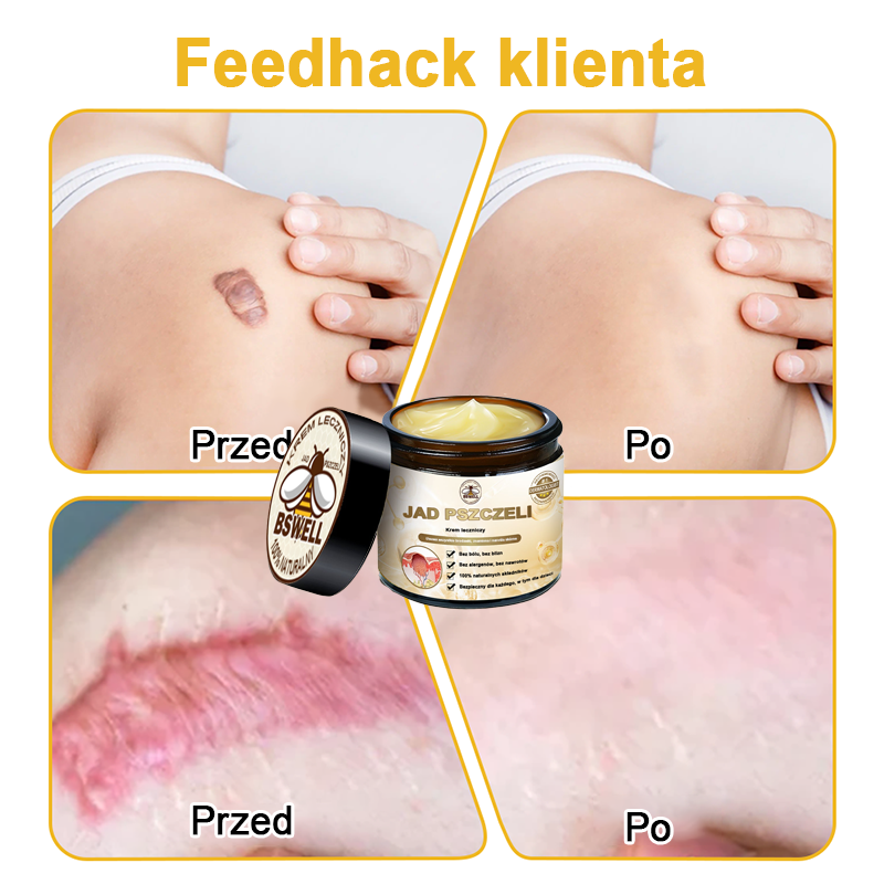 🐝✨𝑩𝑺𝑾𝑬𝑳𝑳® Krem z jadami pszczół 👨‍⚕️ (Rekomendacja dermatologów) (🔥Ostatni dzień promocji, 80% zniżki)