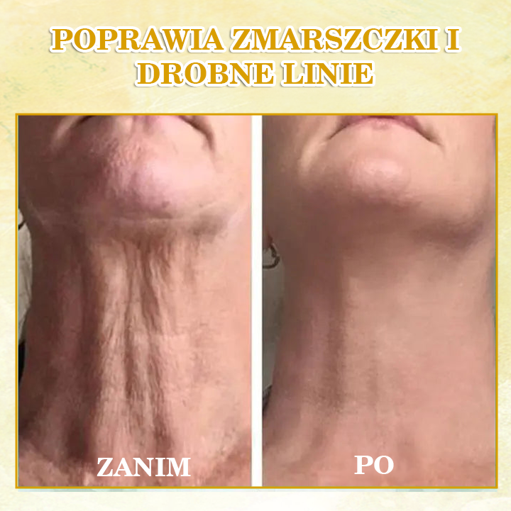 🌟🌟Zniżka ostatniego dnia: 70% ZNIŻKI LEFUN® Ujędrniający olejek odmładzający skórę