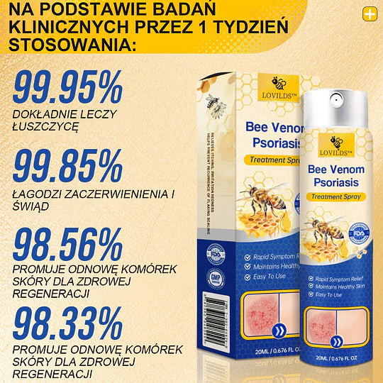 (🔥Płatność przy odbiorze🔥60% zniżki) LOVILDS™ PsoriaHeal Spray na łuszczycę (wysyłka na cały świat – bezpłatna wysyłka)🌐