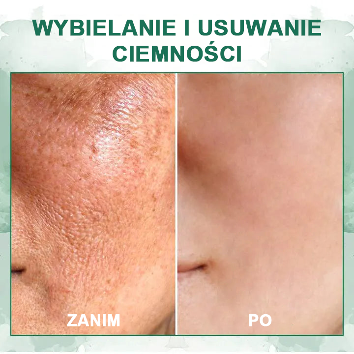 【✨Za pobraniem✨】Wyprzedaż ostatniego dnia 80% taniej - Ujędrniające serum regenerujące Fubsta™