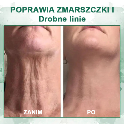 【✨Za pobraniem✨】Wyprzedaż ostatniego dnia 80% taniej - Ujędrniające serum regenerujące Fubsta™