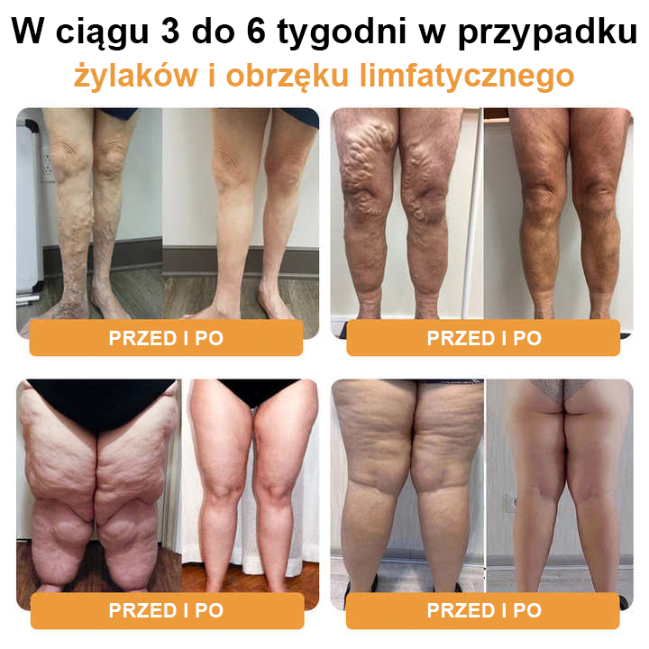 💥Ultradźwiękowa opaska detoksykująca JOSFIT™ z funkcją spalania tłuszczu i równoważenia poziomu cukru we krwi za pomocą dalekiej podczerwieni - limitowana oferta specjalna Energy Balance