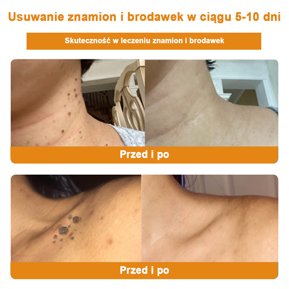 🐝✨𝑩𝑺𝑾𝑬𝑳𝑳® Krem z jadami pszczół 👨‍⚕️ (Rekomendacja dermatologów) (🔥Ostatni dzień promocji, 80% zniżki)