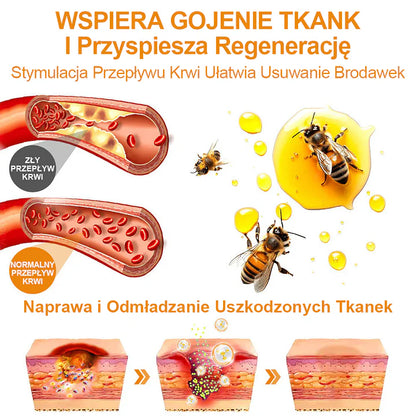 【🌊 Za pobraniem🌊 】 Vsoxa™ Krem do usuwania brodawek i pieprzyków z jadem pszczelim (👨‍⚕Zalecenia AAD) 🐝🐝 (🔥Ostatni dzień wyprzedaży 70% taniej)