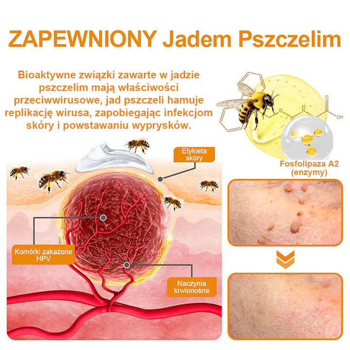 【🌊 Za pobraniem🌊 】 Vsoxa™ Krem do usuwania brodawek i pieprzyków z jadem pszczelim (👨‍⚕Zalecenia AAD) 🐝🐝 (🔥Ostatni dzień wyprzedaży 70% taniej)