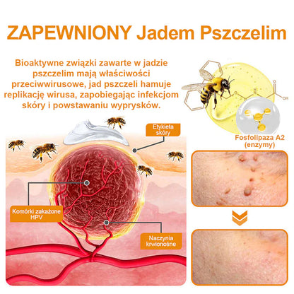 【🌊 Za pobraniem🌊 】 Vsoxa™ Krem do usuwania brodawek i pieprzyków z jadem pszczelim (👨‍⚕Zalecenia AAD) 🐝🐝 (🔥Ostatni dzień wyprzedaży 70% taniej)