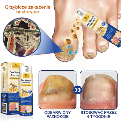 (🔥Płatność przy odbiorze🔥60% zniżki) LOVILDS™ PsoriaHeal Spray na łuszczycę (wysyłka na cały świat – bezpłatna wysyłka)🌐