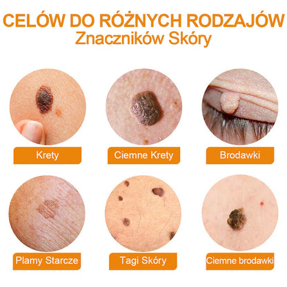 【🌊 Za pobraniem🌊 】 Vsoxa™ Krem do usuwania brodawek i pieprzyków z jadem pszczelim (👨‍⚕Zalecenia AAD) 🐝🐝 (🔥Ostatni dzień wyprzedaży 70% taniej)