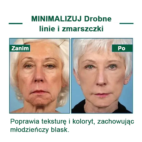 【✨Za pobraniem✨】Wyprzedaż ostatniego dnia 80% taniej - Ujędrniające serum regenerujące Fubsta™